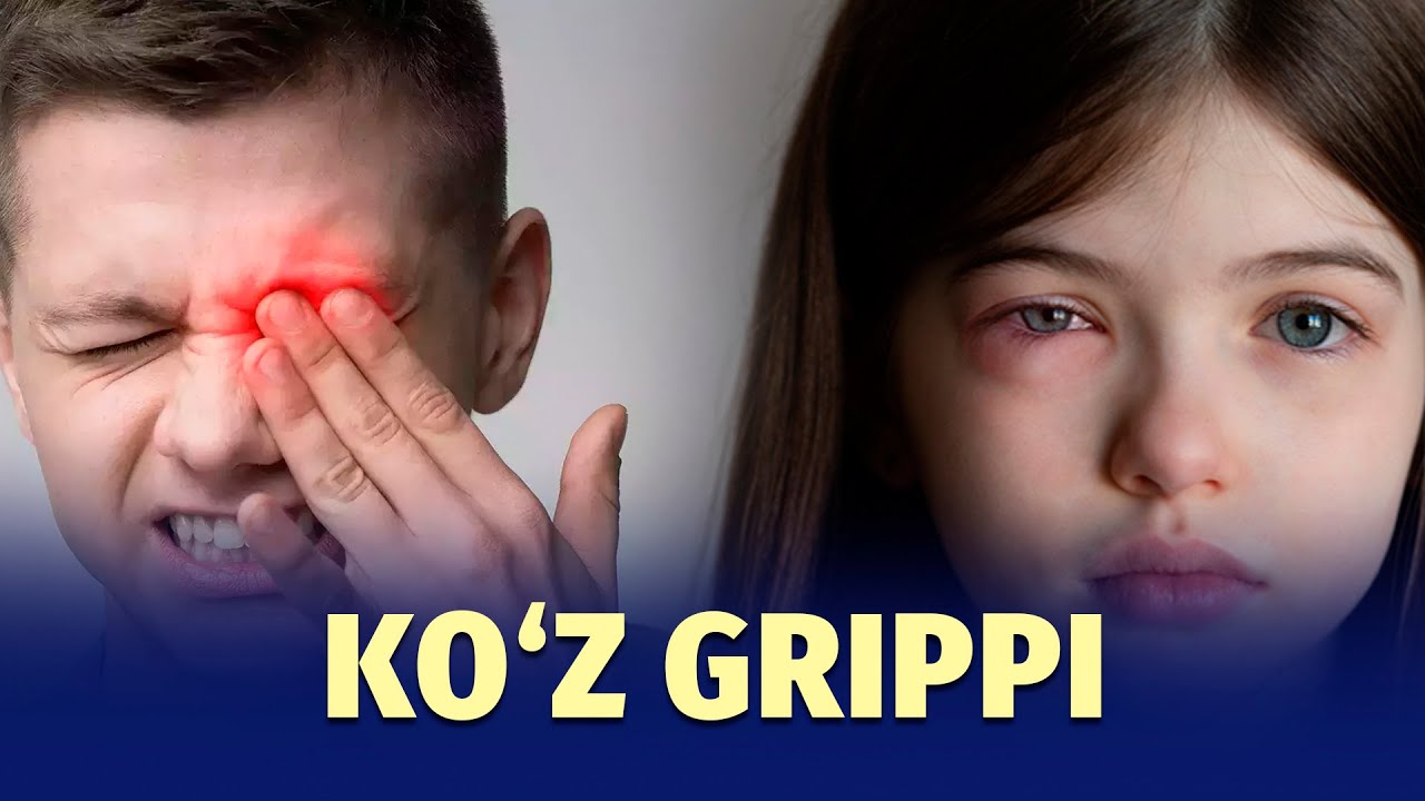 Shishgan, qizargan ko‘zlar – konyunktivitni qanday davolash mumkin?