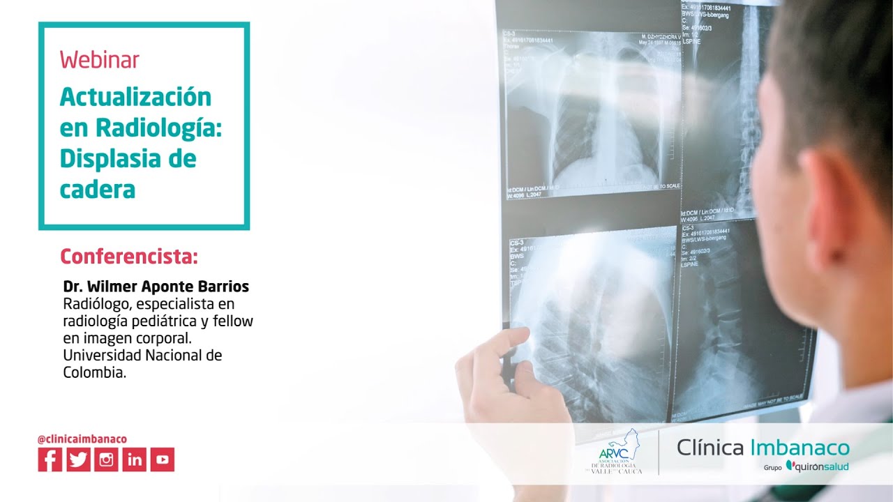 Actualización en Radiología: Displasia de cadera | Webinar