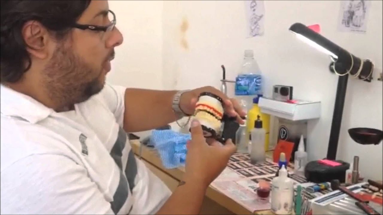Laboratório de Prótese Central do Sorriso - Confecção de Placa Miorrelaxante Superior (Bruxismo)
