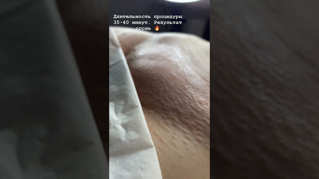 #шугаринг #глубокоебикини #ваксинг #депиляция