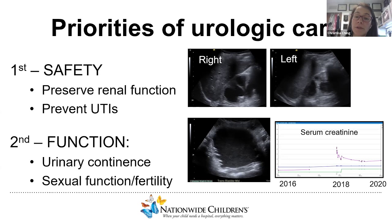IVUmed VVP: Neurogenic Bladder with Dr. Christina Ching
