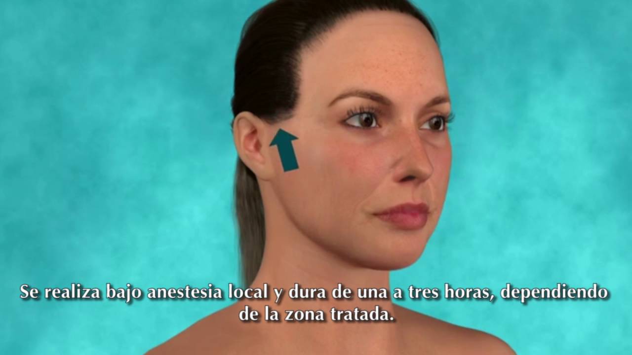 Mini Lifting Facial - Clinica Thuel