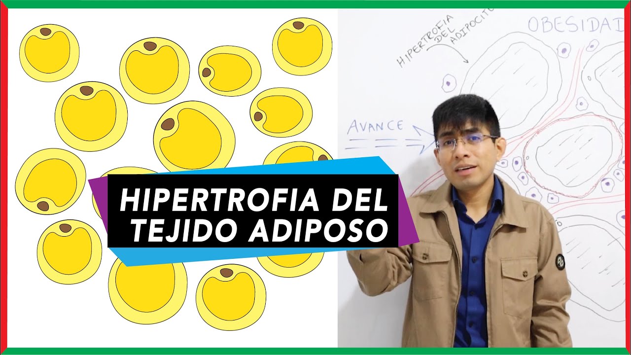 Hipertrofia del tejido adiposo | Obesidad e Inflamación