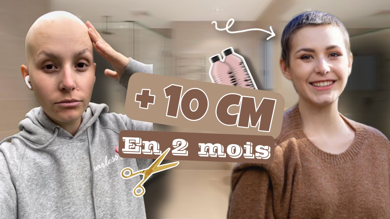 JE NE SUIS PLUS CHAUVE ! 👩🏻‍🦲