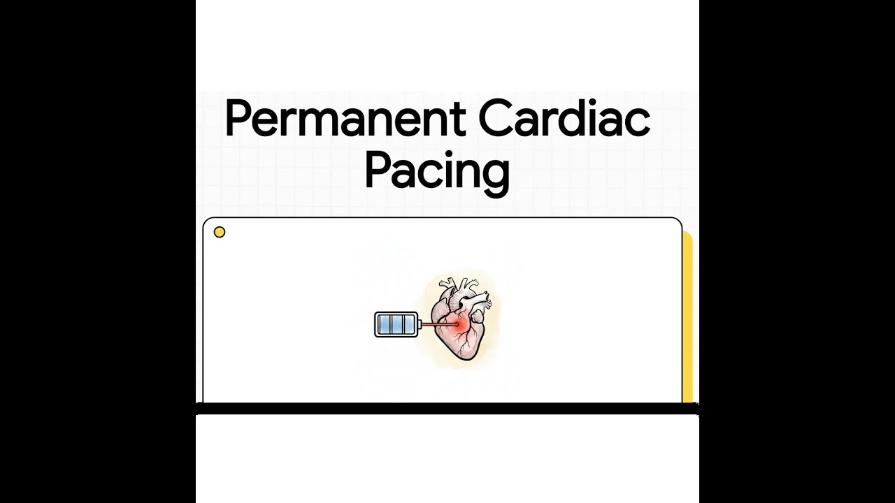Permanent Cardiac Pacing | Indications, Devices & Clinical Decision-Making