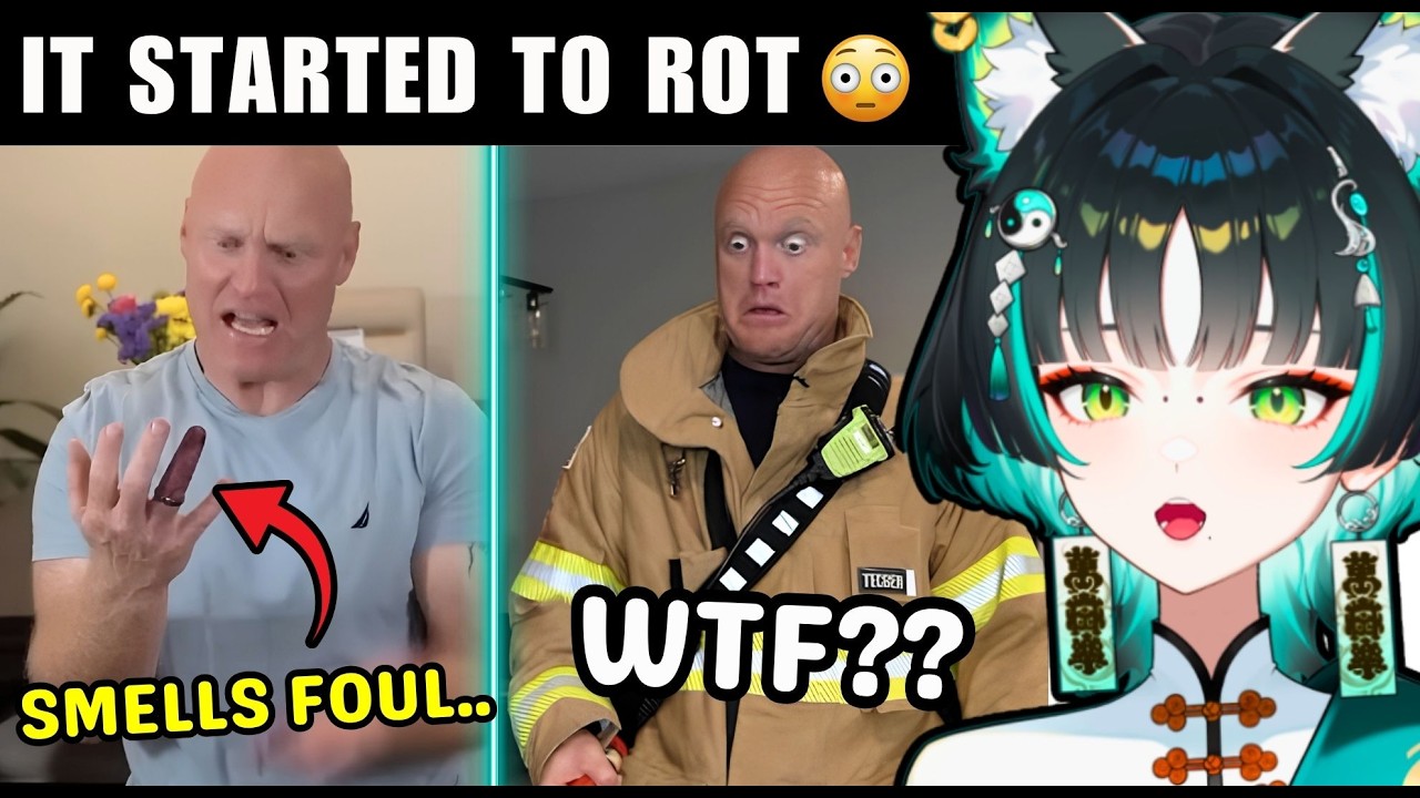 HIS FINGER TURNED BLACK!? | Fire Department Chronicles Reaction