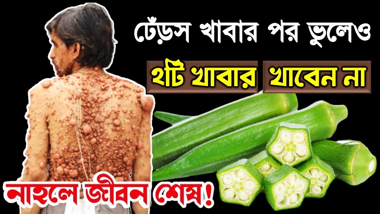 ঢেঁড়স খাবার পরে ভুল করেও এই খাবারগুলো খাবেন না ┇ ভিডিওটি আপনার প্রাণ বাঁচাবে ┇ 1 বার হলেও দেখুন