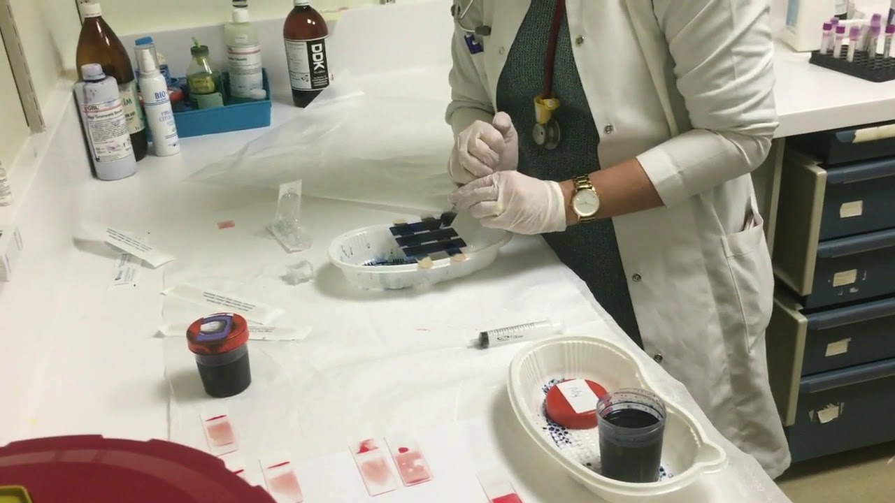 Periferik Kan Yayması Nasıl Hazırlanır? (Peripheral Blood Smear/Blood Film)