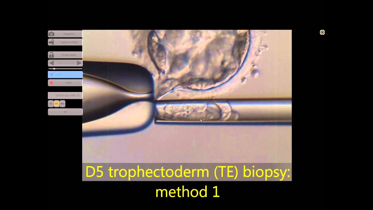 Hatching blastocyst biopsy