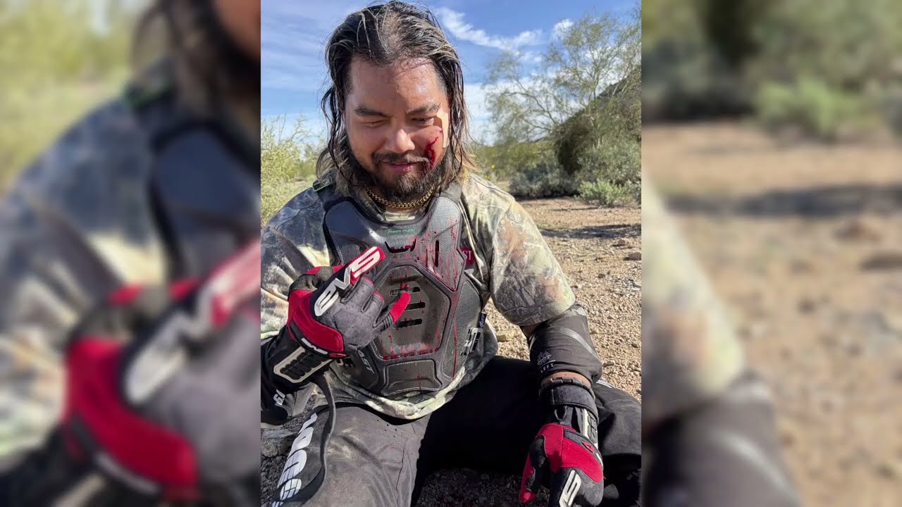 Sometimes a good day on MTB can go bad ( Insta360 Go Ultra)