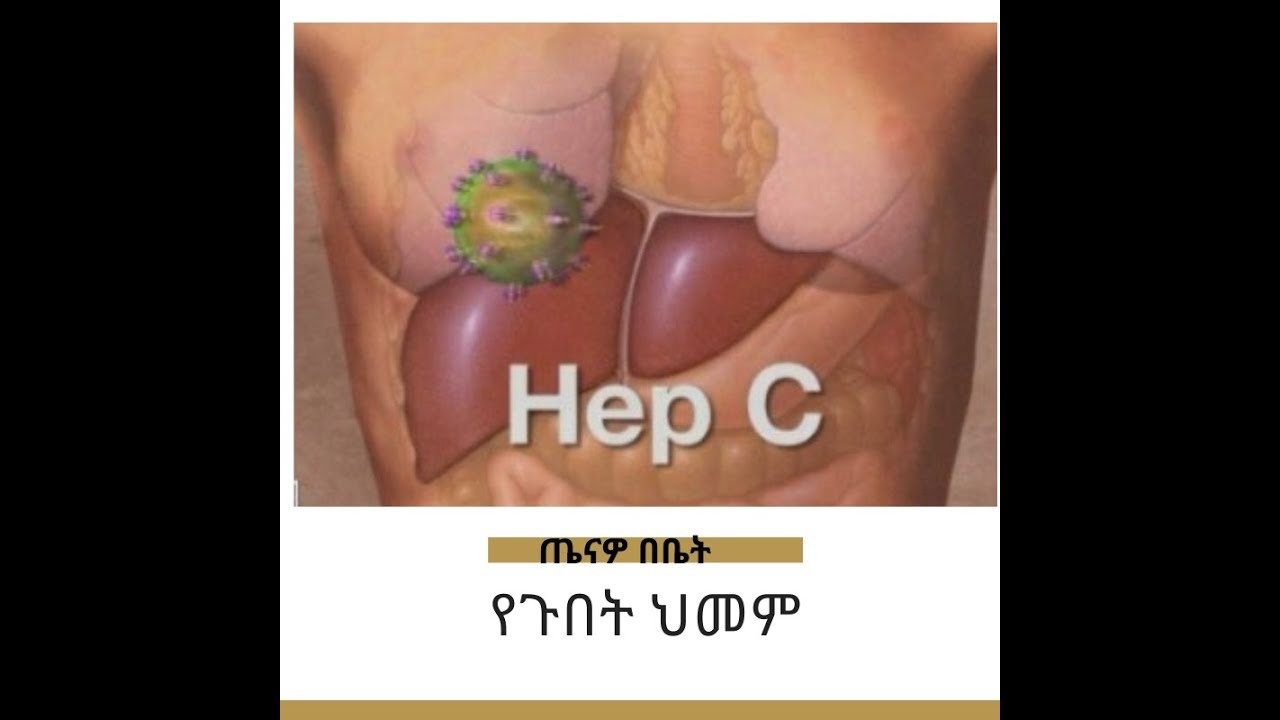 ጤናዎ በቤት - የጉበት ህመም  በተመለከተ ከባለሙያ ጋር የተደረገ ውይይት  |  tenawo bebetwo