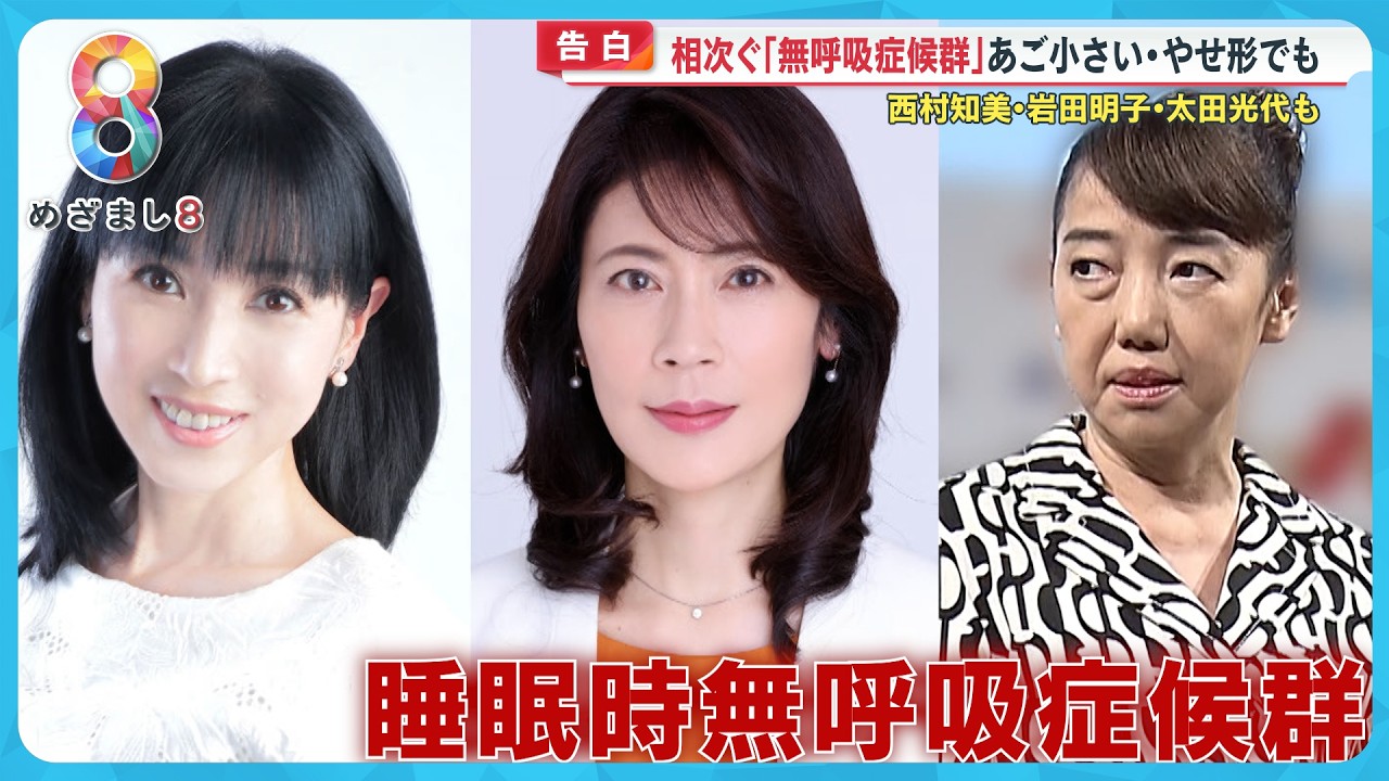 【告白】｢睡眠時無呼吸症候群｣の恐怖 あご小さい・やせ形女性にも増加…西村知美・太田光代・岩田明子も…治療法は？【めざまし８ニュース】