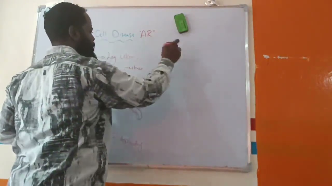 Sickle Cell Disease Dr.Ahmed Adlan