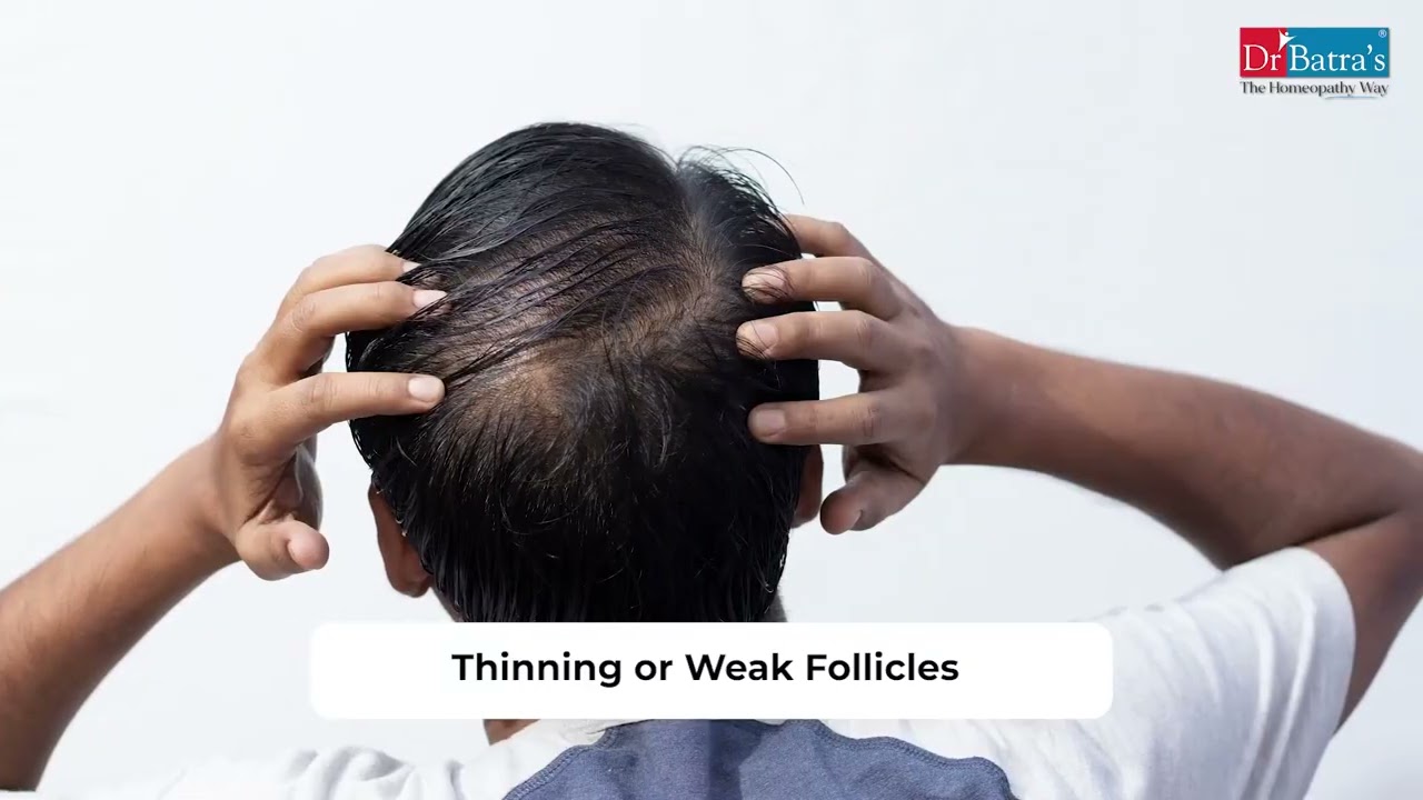 Advanced Hair Loss Treatment | XOGEN by Dr Batra's hair growth