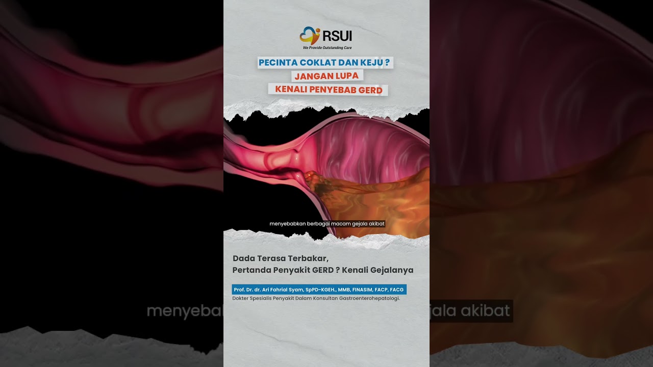 Pecinta Coklat dan Keju? Jangan Lupa Kenali Penyebab Gerd #gerd #asamlambung #rsui