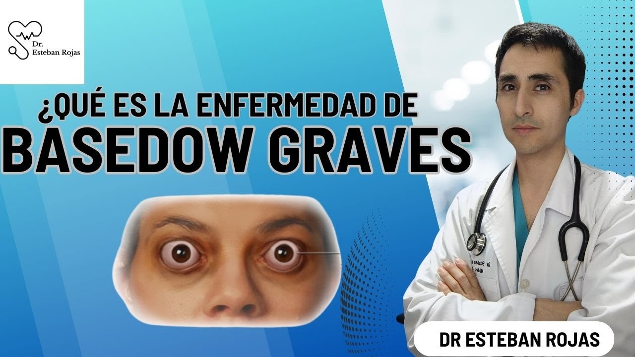 ¿Qué es la enfermedad de Basedow Graves?