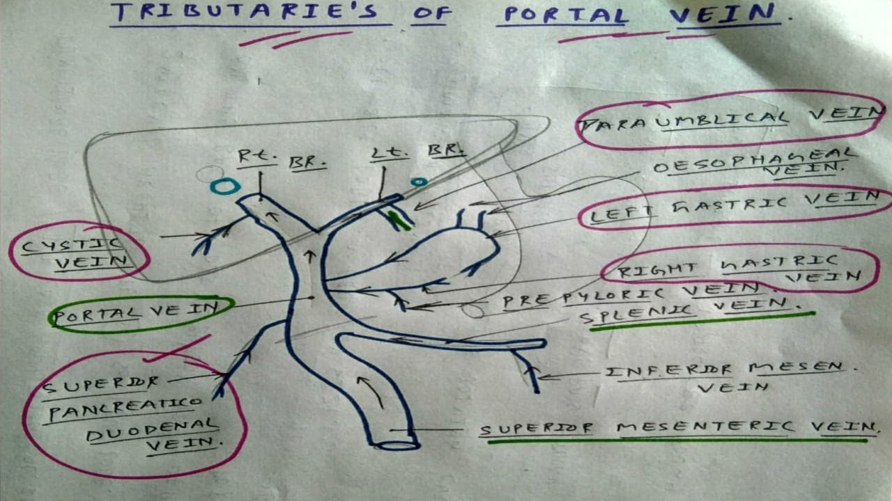 Tributaries of Portal Vein | Splenic Vein, Superior Mesenteric Vein | TCML