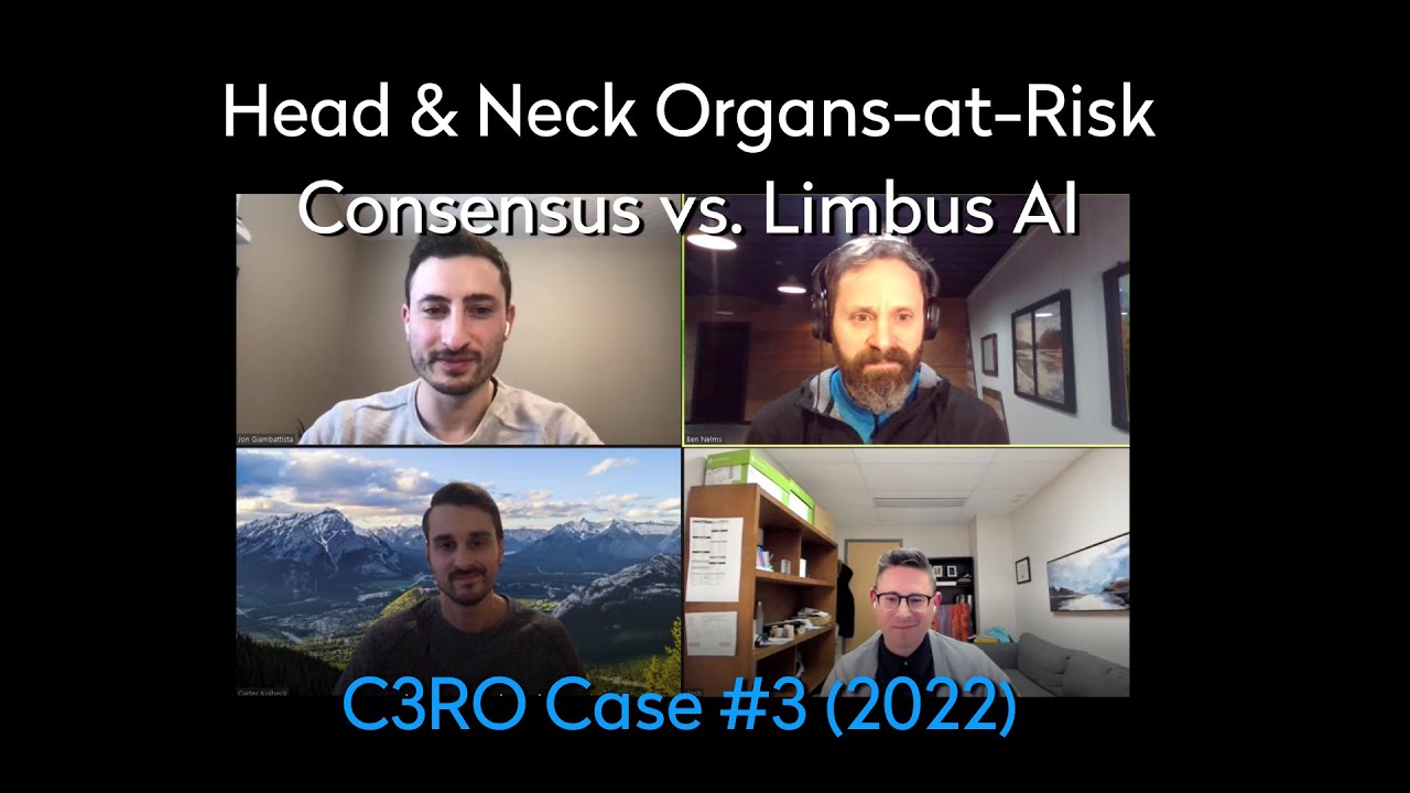 Head & Neck Organs-at-Risk: Consensus vs. Limbus AI