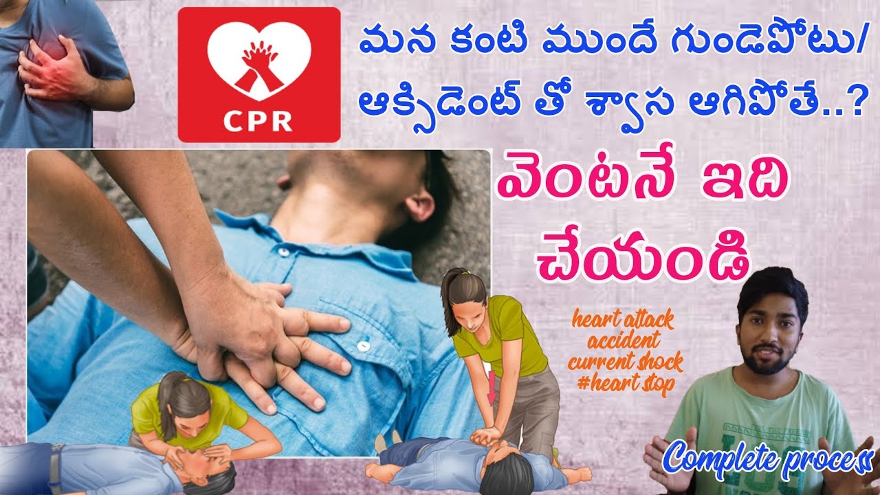 CPR Emergency Procedure (heart stop) | Hands only CPR Complete process