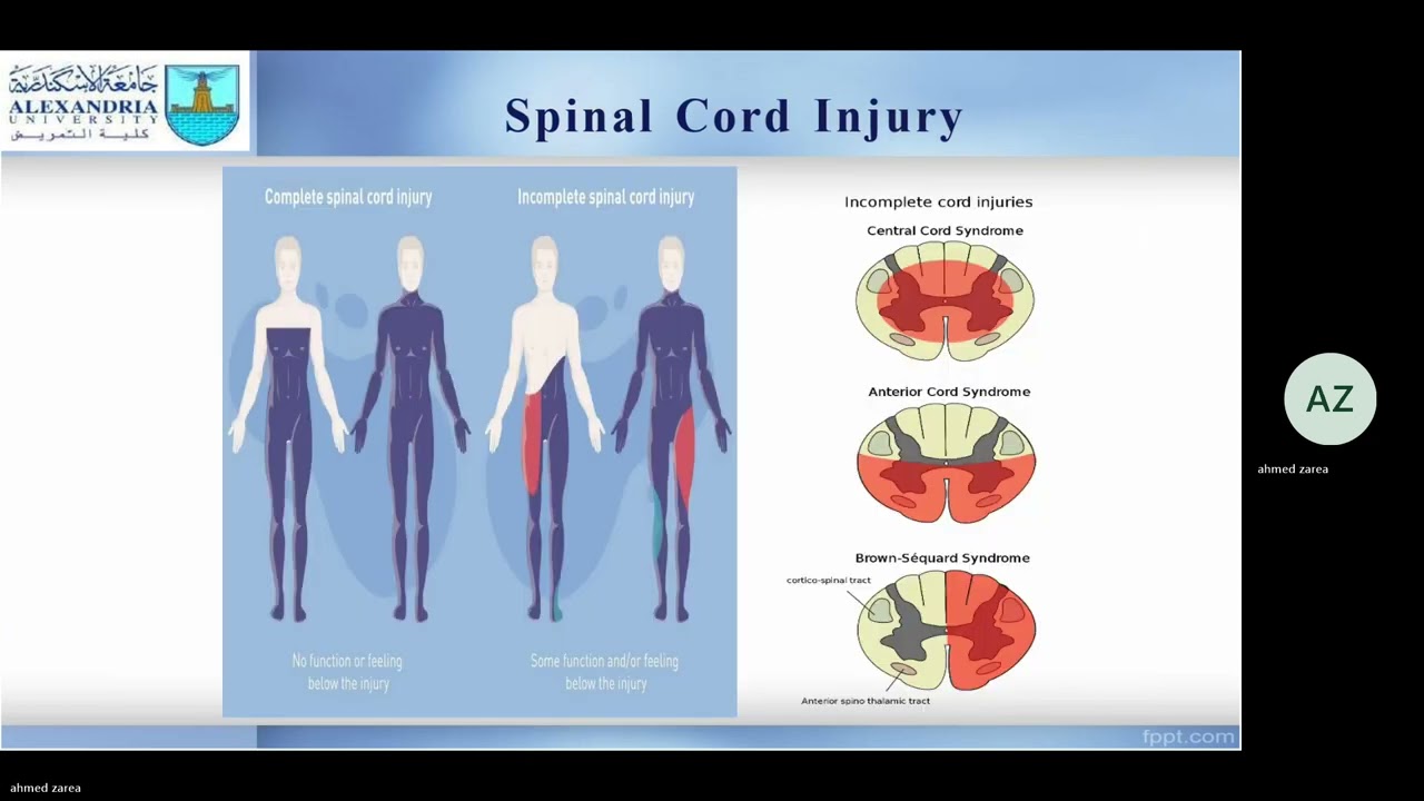 spinal cord injury