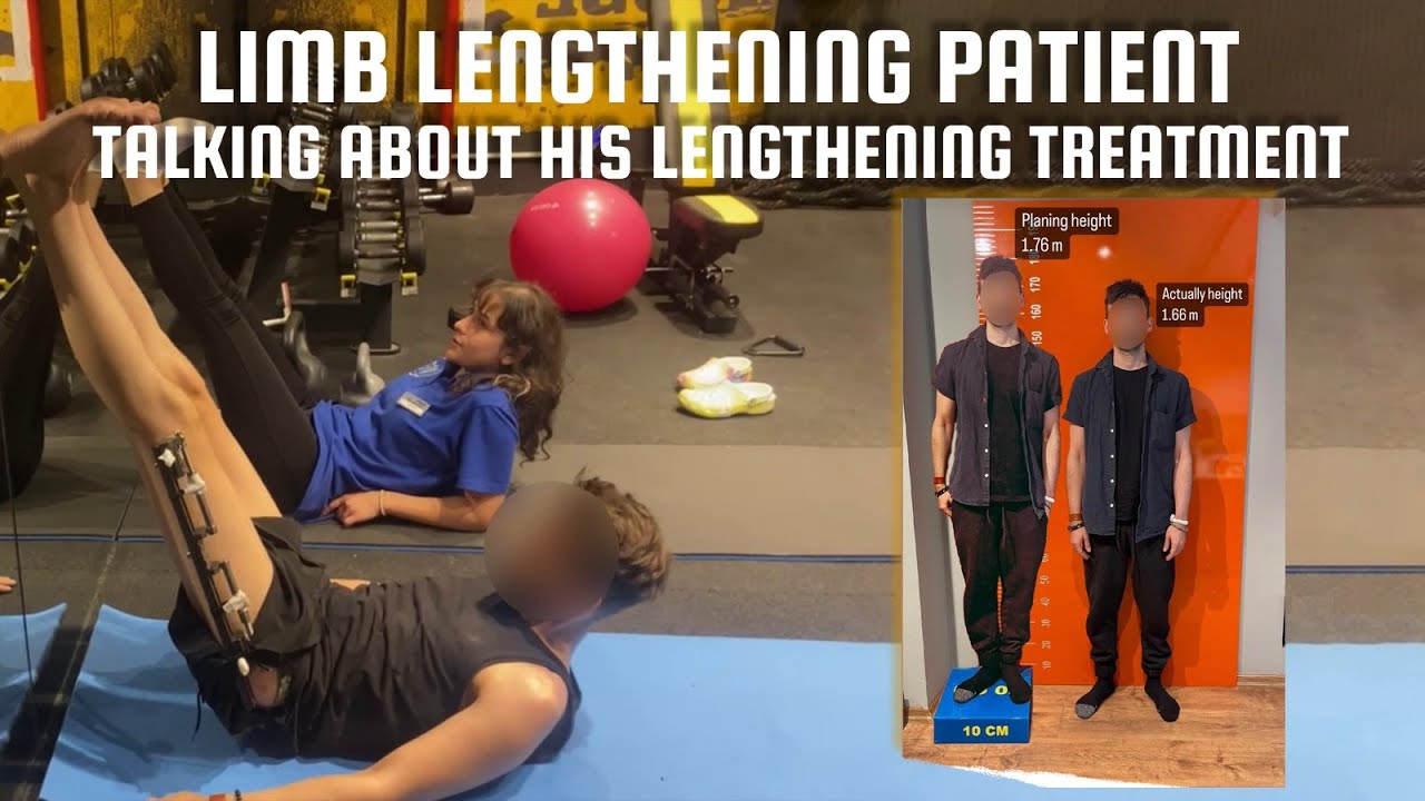 Limb lengthening patient talking about his lengthening Progress. My experience with LON-Method