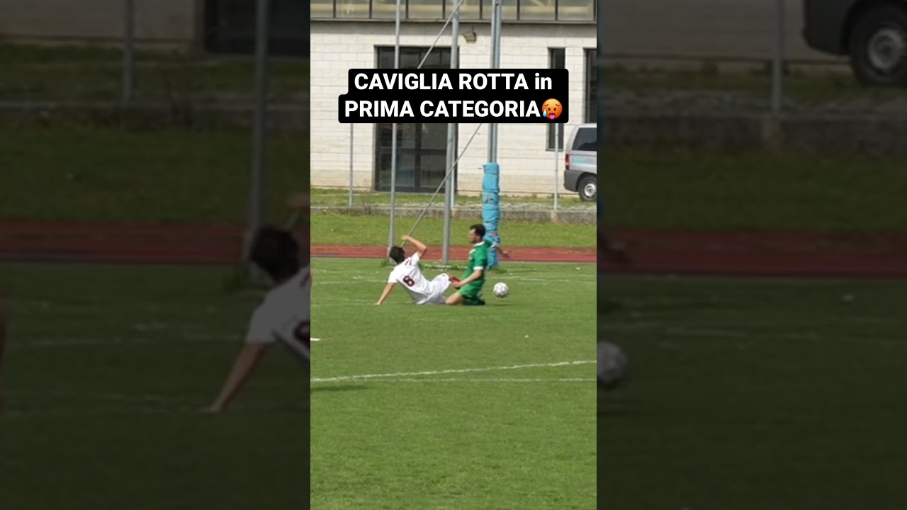 Caviglia rotta 🤬 #shorts