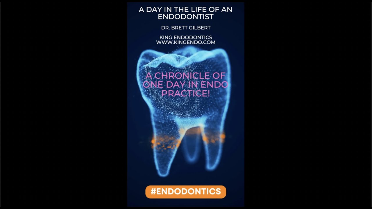 A DAY IN THE LIFE OF AN #ENDODONTIST!  A REAL LIFE CHRONICLE OF A SINGLE DAY IN ENDO PRACTICE!