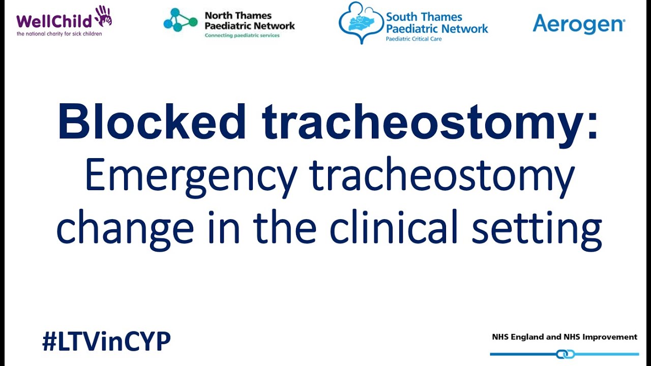 Blocked Tracheostomy: Emergency tracheostomy change in the clinical setting