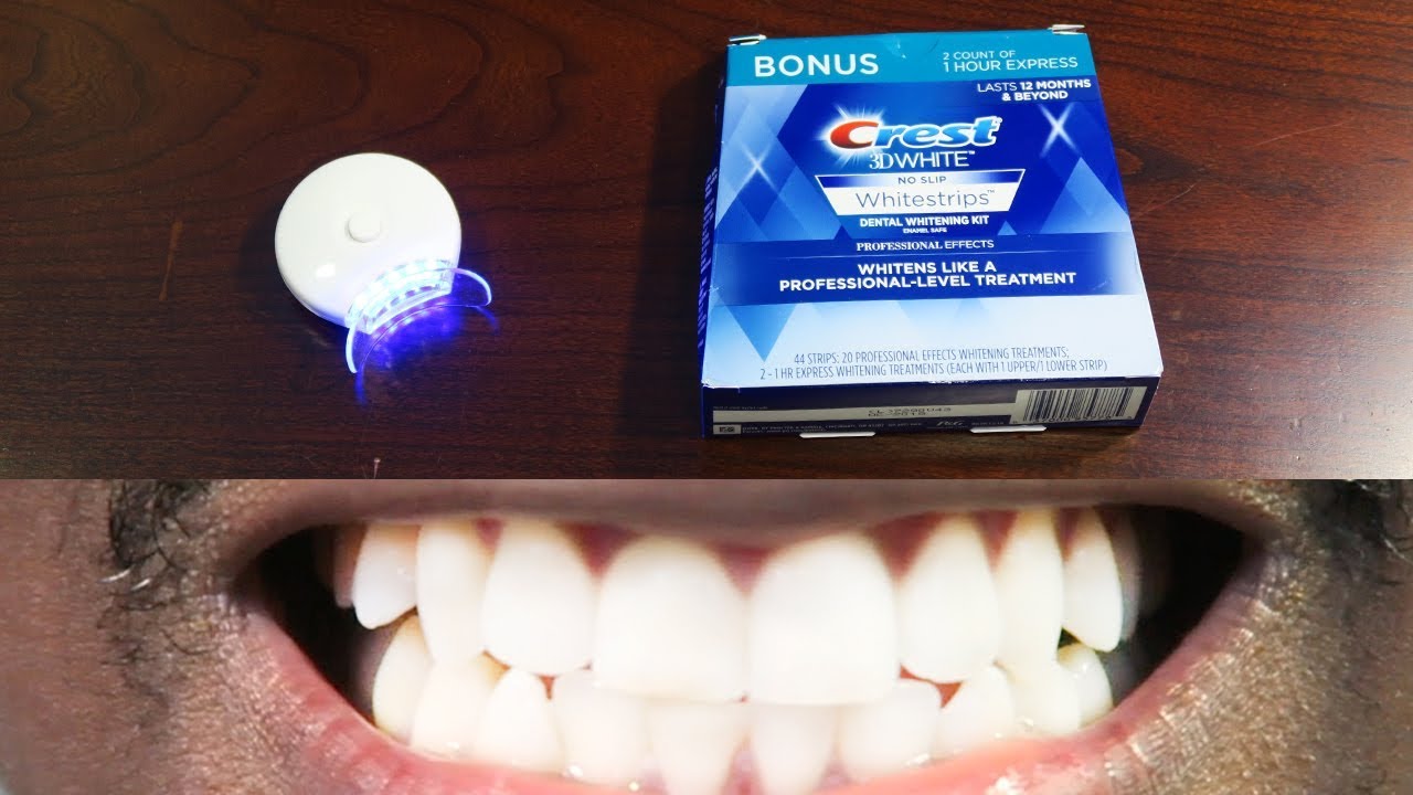 How To Whiten Teeth Easy! • AuraGlow LED Light & Crest 3D Whitestrips