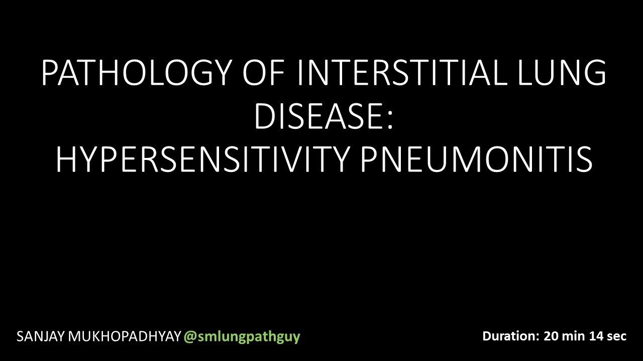 Pathology of interstitial lung disease: hypersensitivity pneumonitis