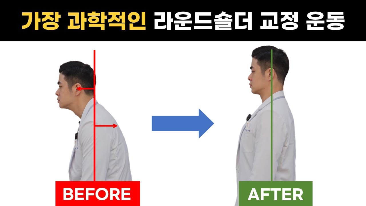 [흉추, 등 세우기] 라운드숄더, 거북목 교정, 어깨, 목 스트레칭 그만하세요