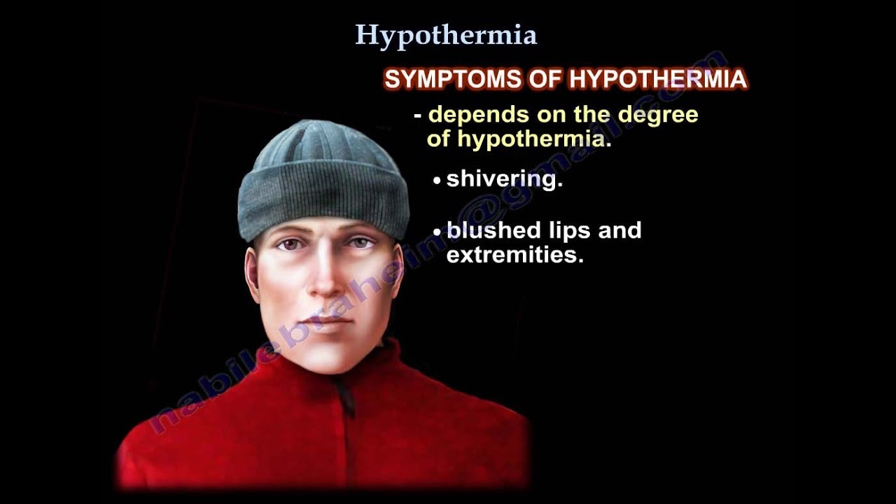 Hypothermia , UPDATE - Everything You Need To Know - Dr. Nabil Ebraheim