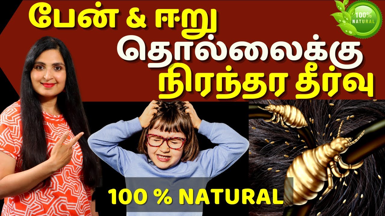 பேன், ஈறு -க்கு Bye Bye!/ How to Get rid of Head Lice & Nits/ Treat Lice Without Chemicals #Headlice