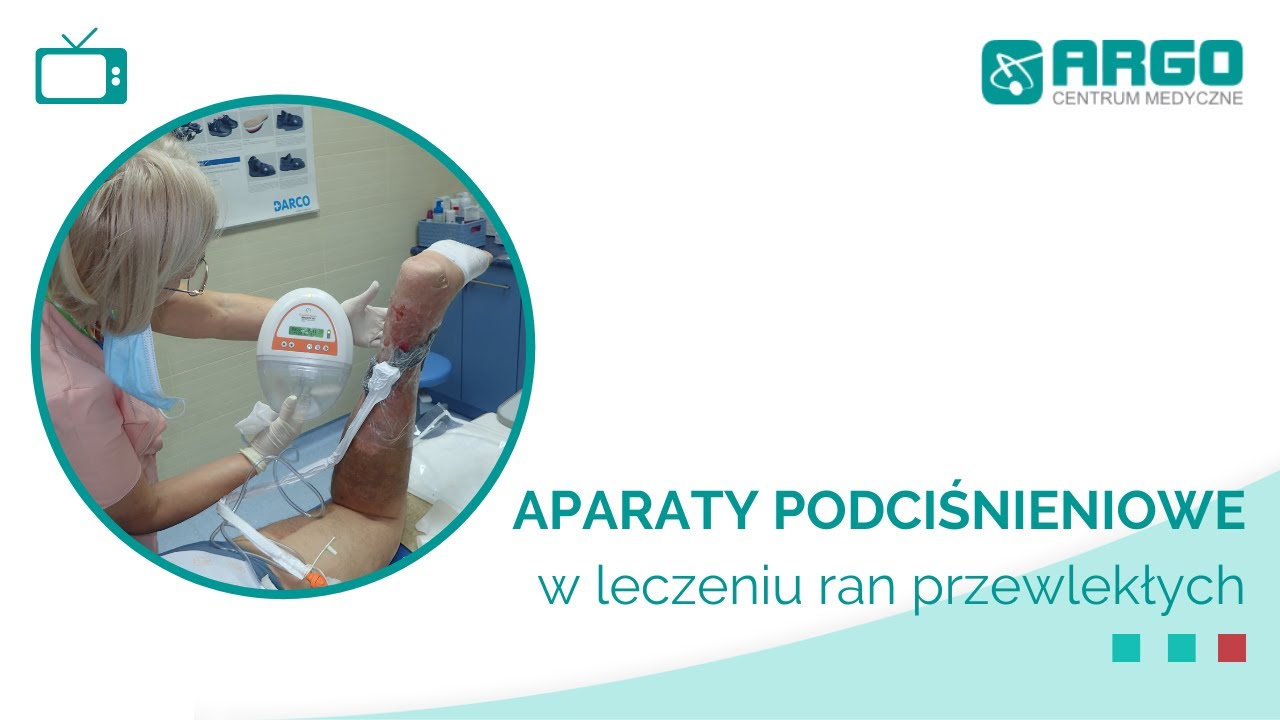 Terapia podciśnieniowa VAC | Pracownia Leczenia Ran