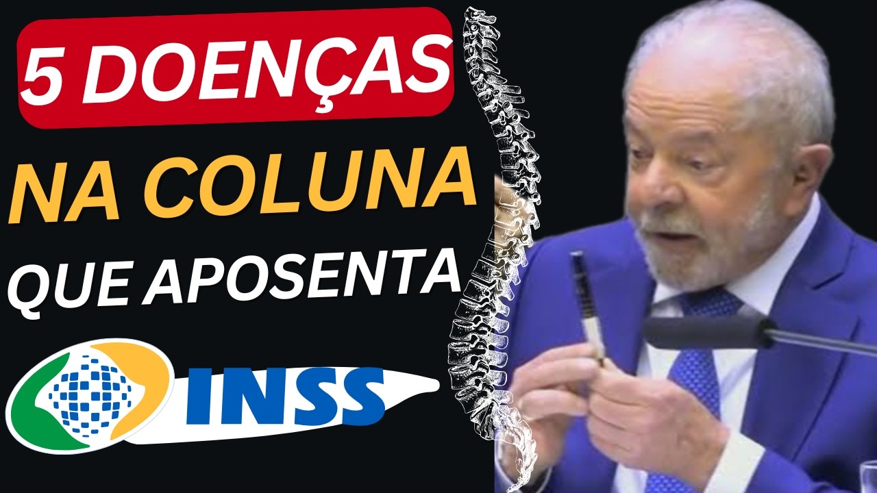 5 Doenças na Coluna que Aposenta pelo INSS