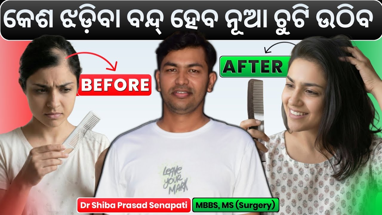 କେଶ ଝଡ଼ିବା ସଂପୂର୍ଣ୍ଣ ବନ୍ଦ୍ ହେବ ଏହି ଘରୋଇ ଉପାୟ#hairfall