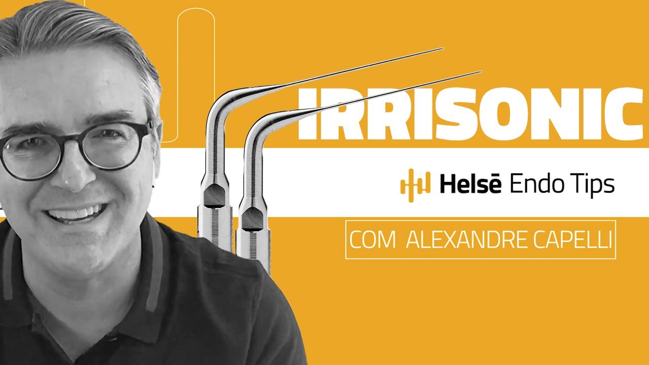 ATIVAÇÃO DA SOLUÇÃO IRRIGADORA - ENDO TIPS