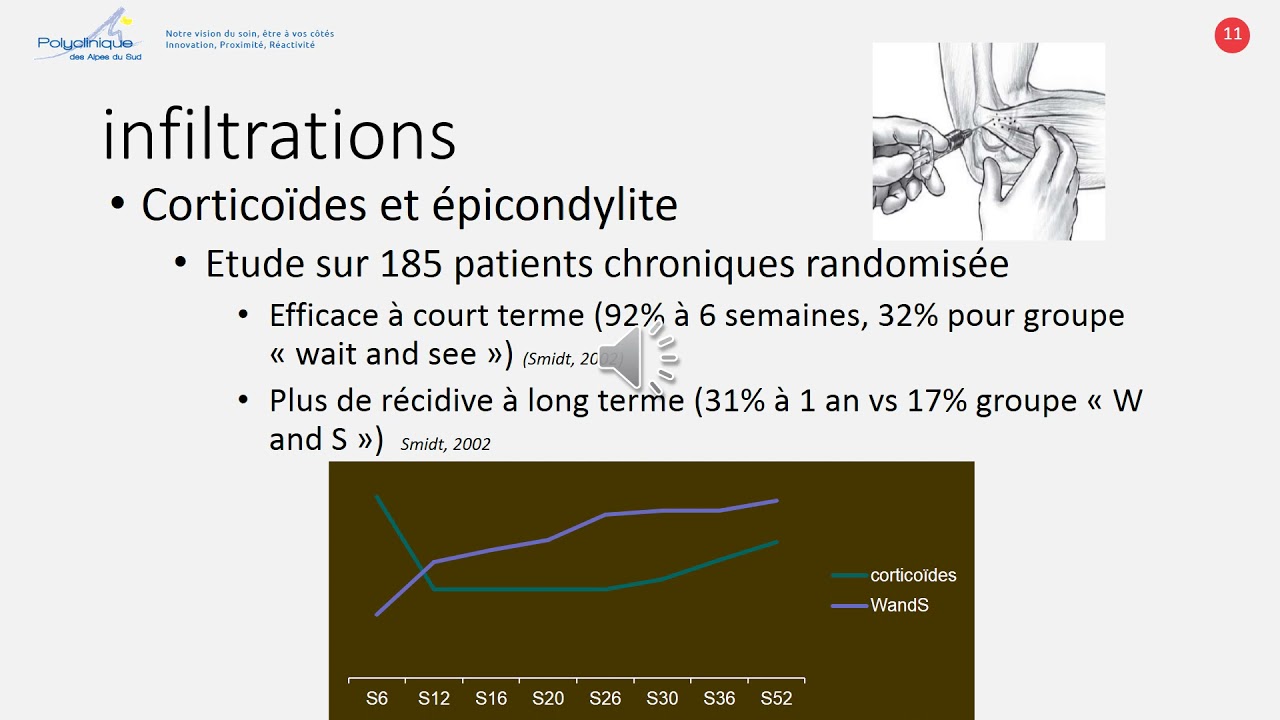Traitement des épicondylites : quoi de neuf en 2021