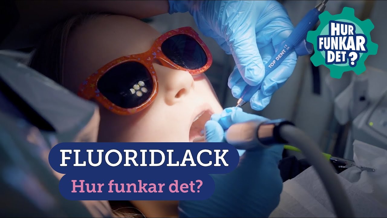 Fluoridlack