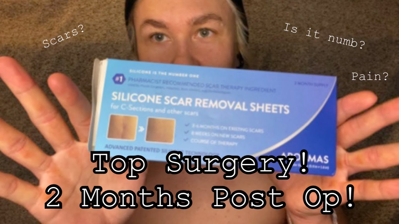 My FTM top surgery (2 months post-op)