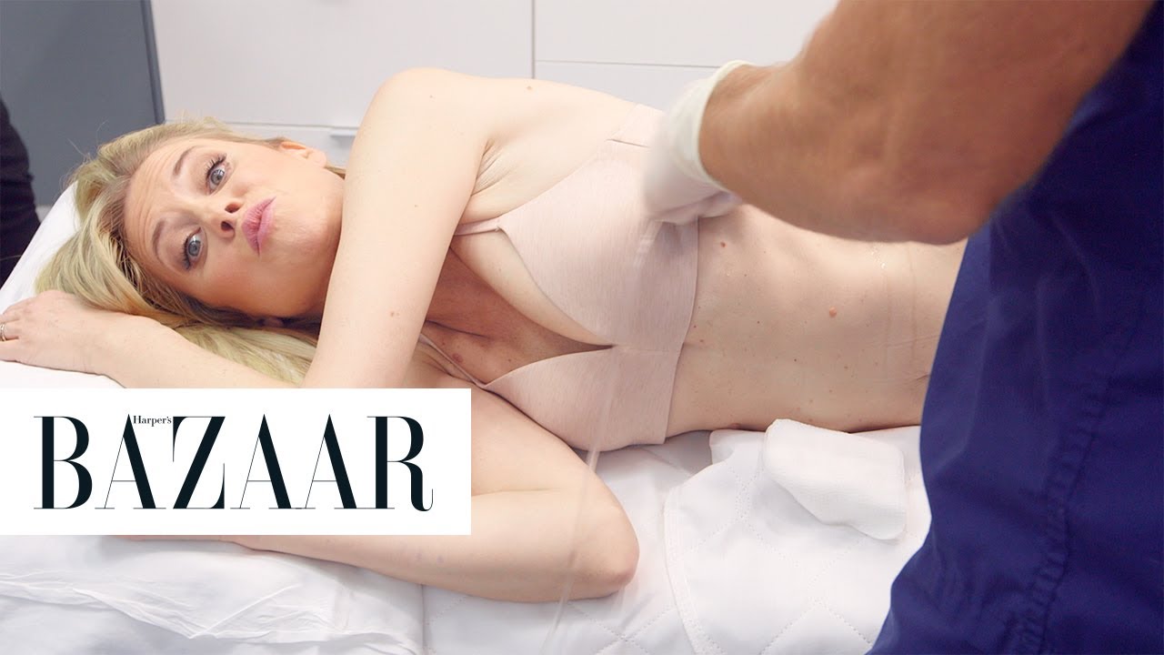 I Tried Airsculpt Liposuction | The Younger Games | Harper's BAZAAR