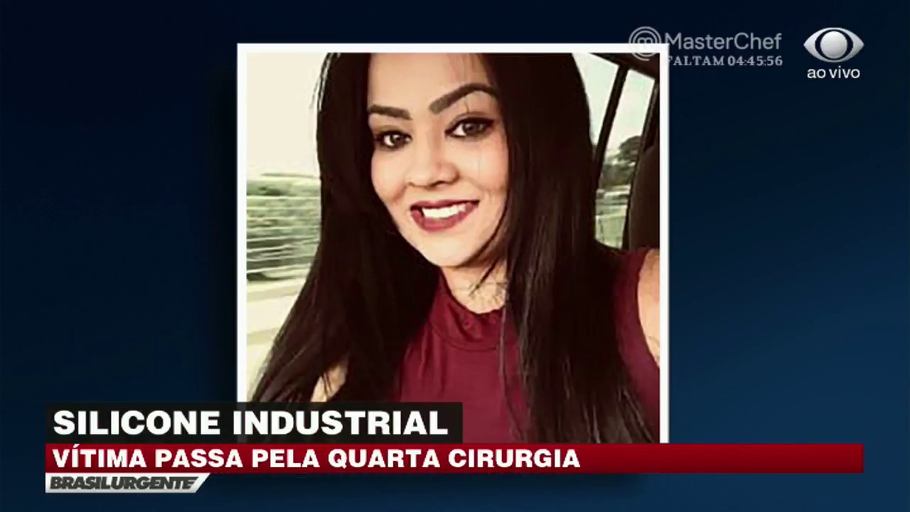 Vítima de bioplastia irregular é operada pela 4ª vez