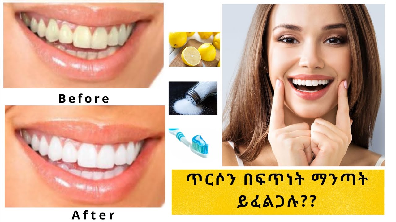 ለጥርስ ንጣት ፈጣን የሆነ መፍትሄ / How to instantly whiten teeth at home