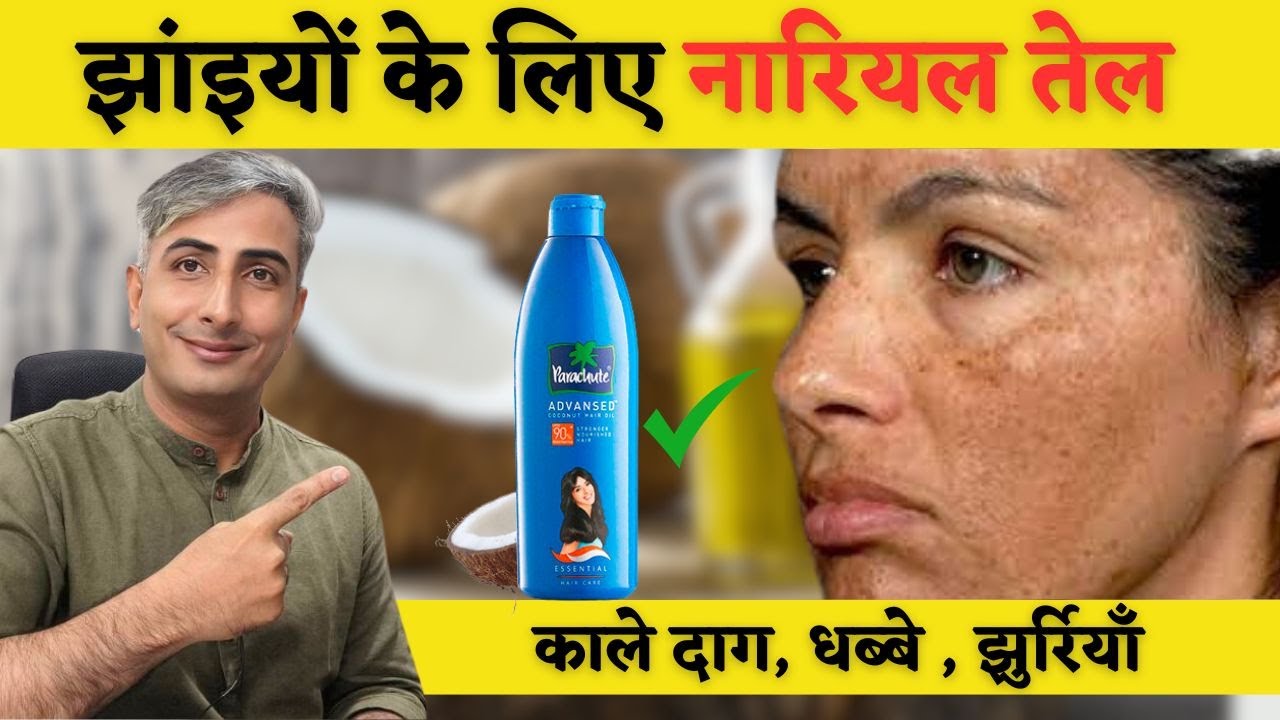 नारियल के तेल में बस ये मिला के लगाओ  झाईयाँ  जड़ से ख़त्म होंगी | DR. MANOJ DAS #drmanojdas