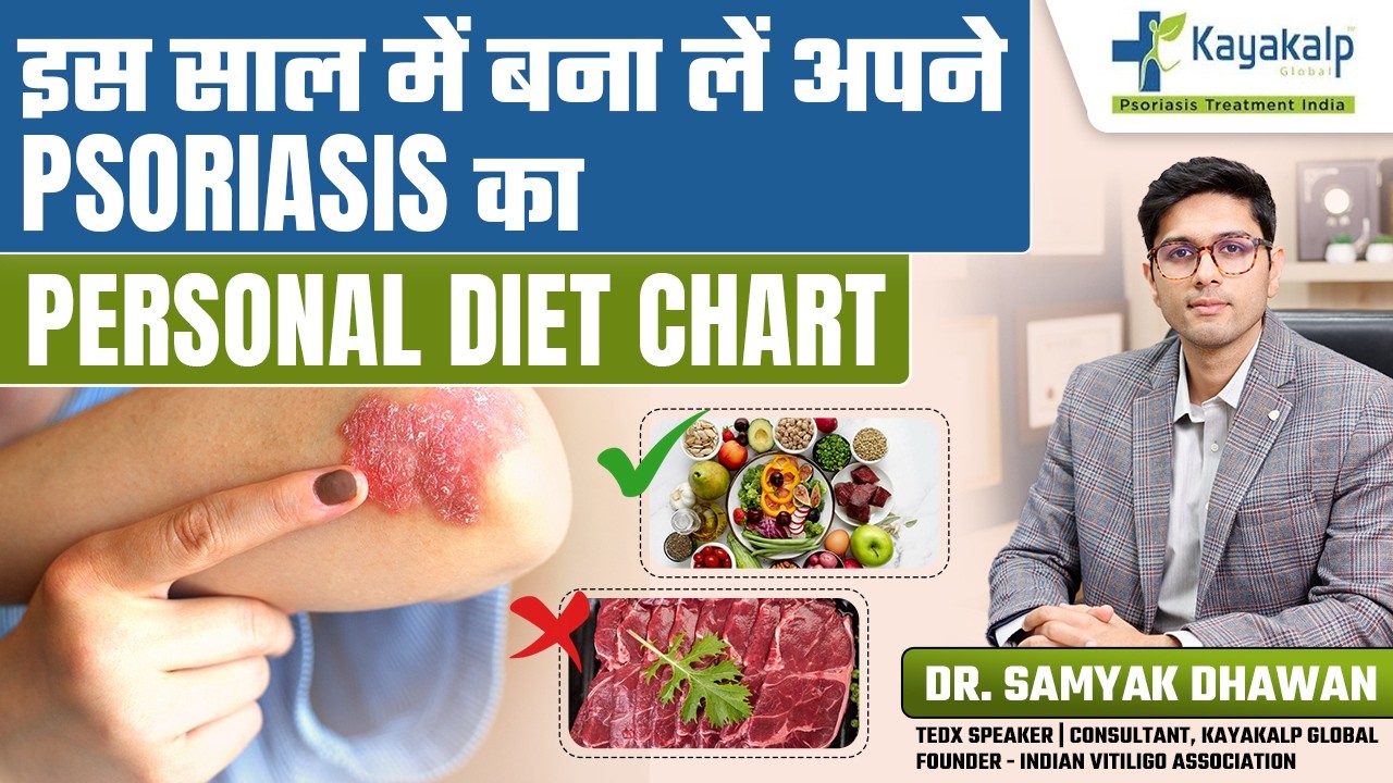Psoriasis का Personal Diet Chart क्या खाएं और क्या बिल्कुल न खाएं? | Psoriasis Treatment India