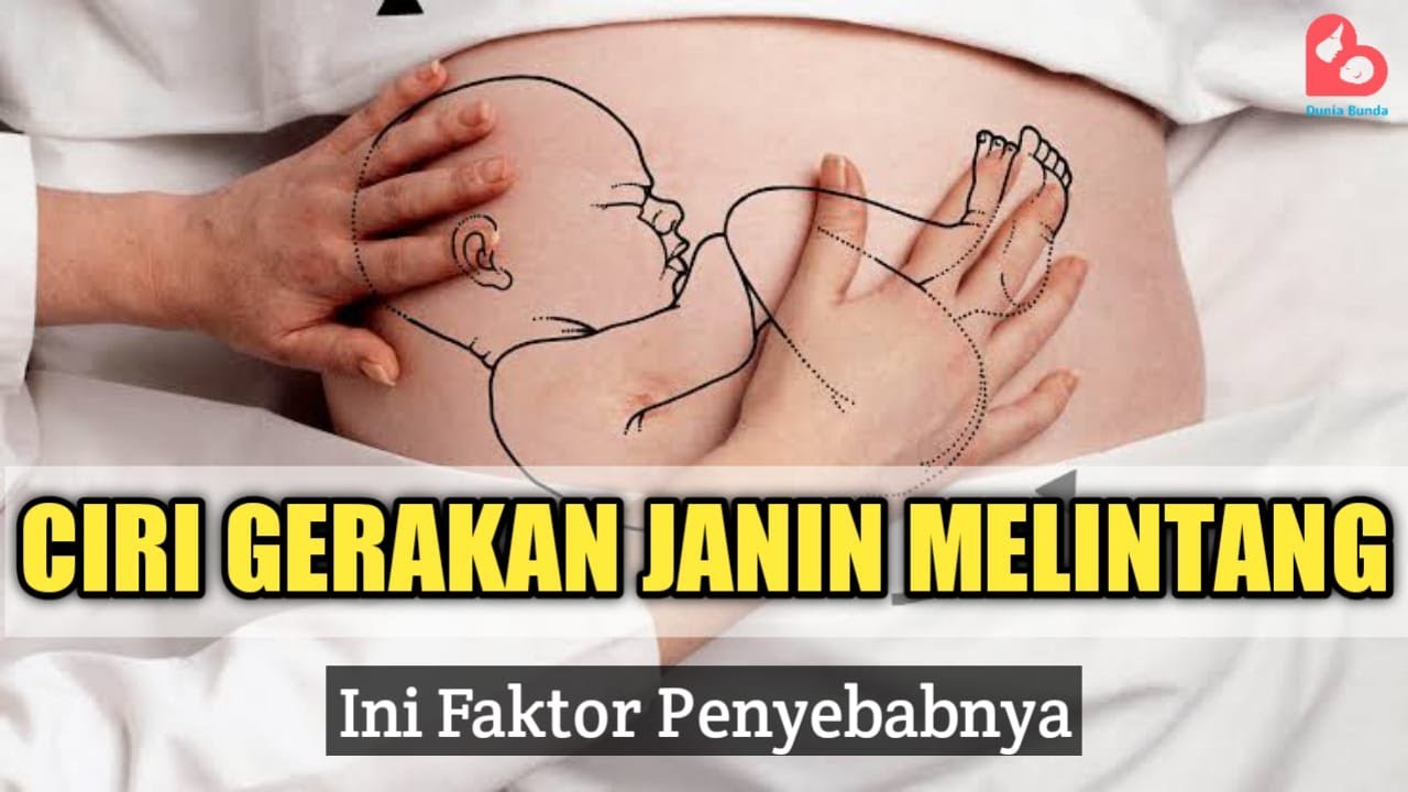 CIRI GERAKAN JANIN MELINTANG SERTA HAL YANG MENYEBABKANNYA..