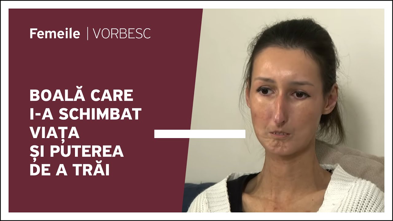 Rodica Moldovanu vorbește despre boală care i-a schimbat viața și puterea de a trăi