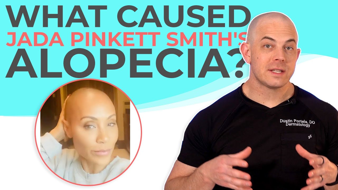 What Does Alopecia Mean? | 208SkinDoc