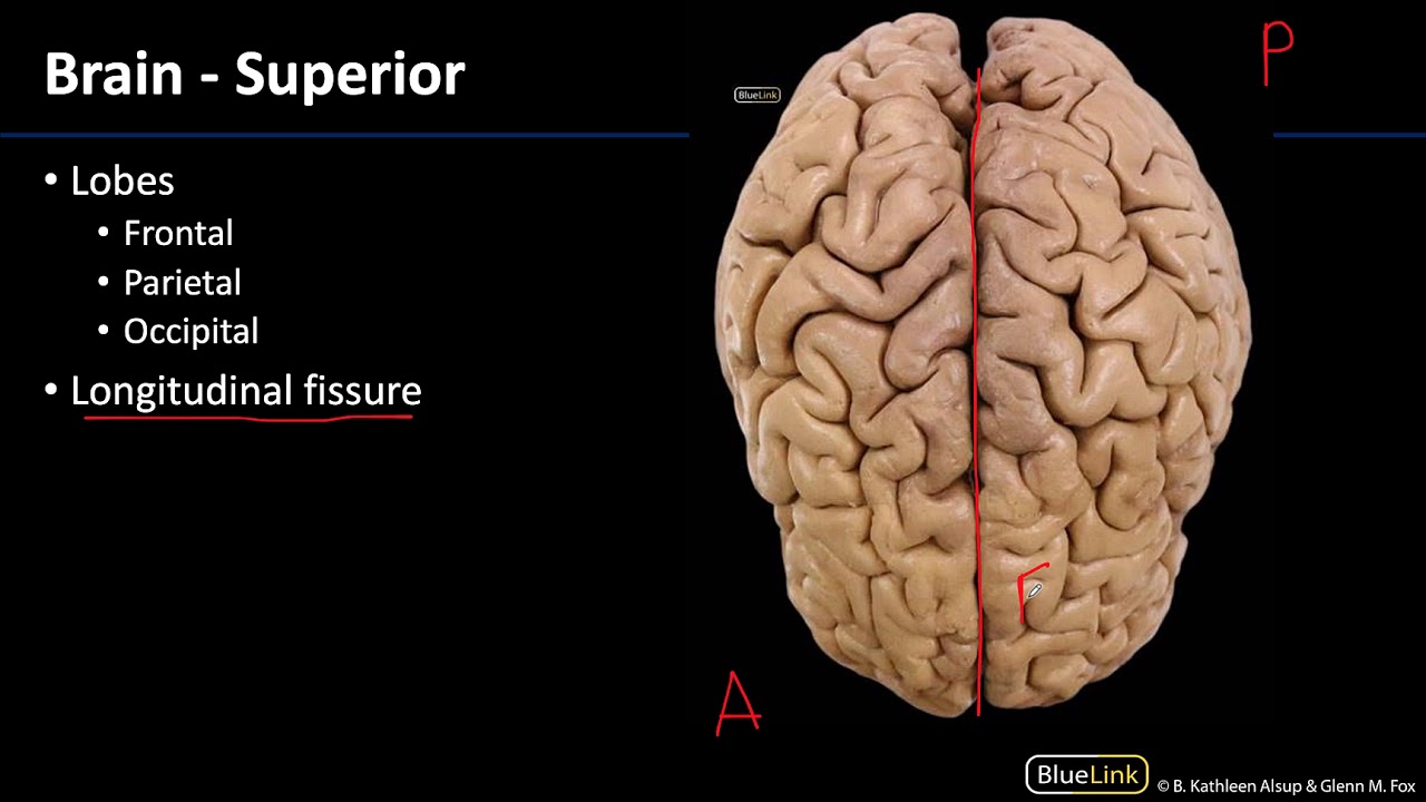 Cranial Cavity and Brain - Brain