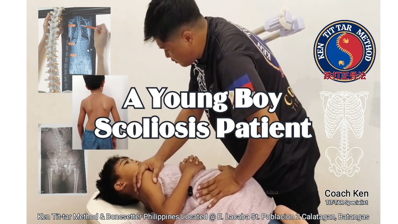 A Non Surgical Treatment for Scoliosis